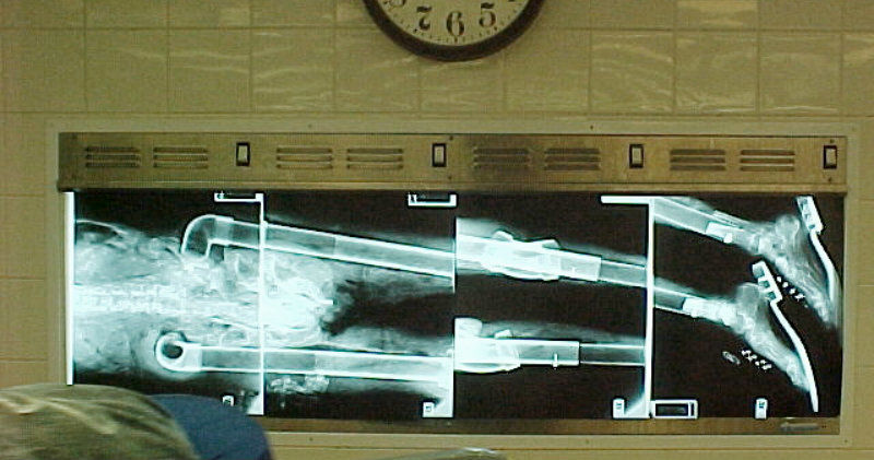 Röntgenbild av stulna kroppar i dokumentären "New Yorks handel med stulna kroppar" i TV4 Play